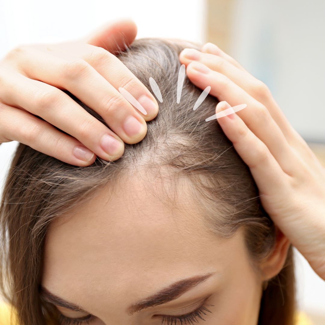 caida cabello mujer